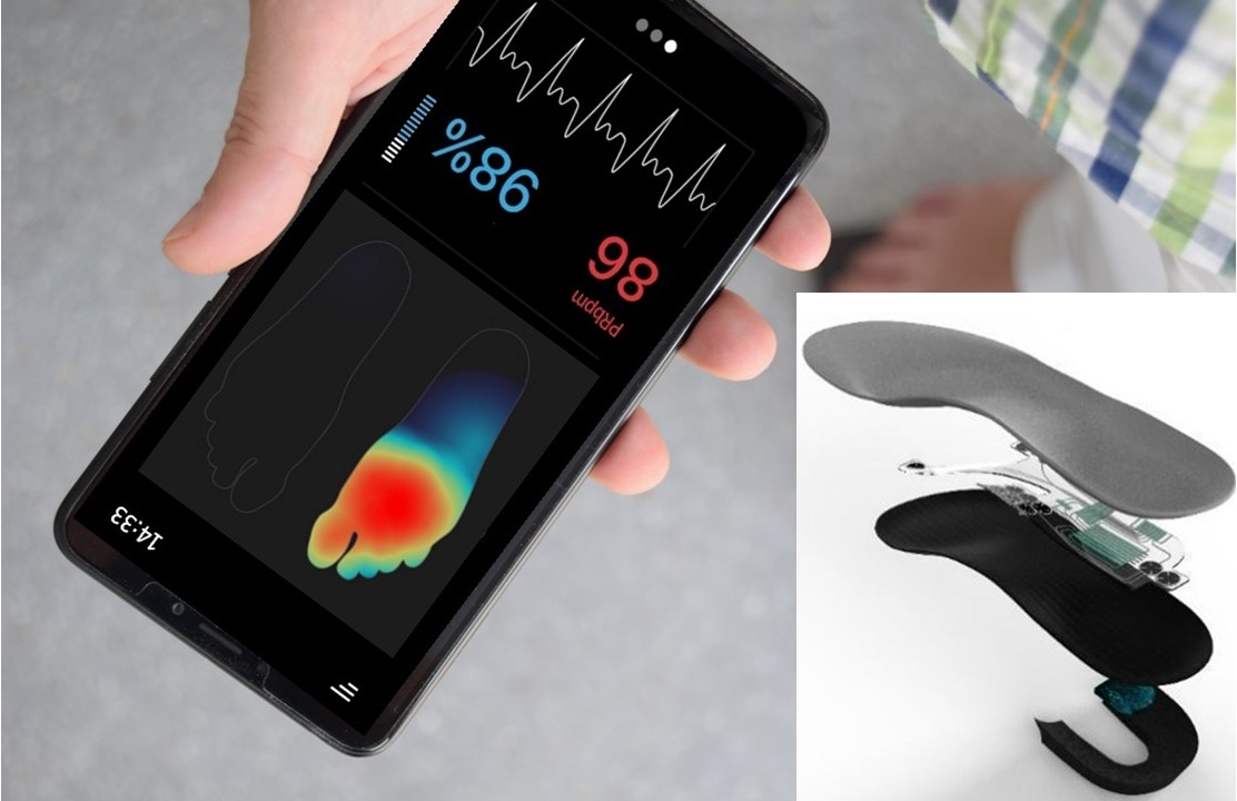 En este momento estás viendo Plantillas inteligentes que ayudan a caminar mejor a personas con Parkinson